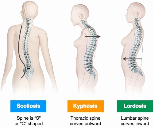 Back Abnormalities Congenital Disorders of the Spinal Cord - Kovilpatti Venkateswara Hospitals